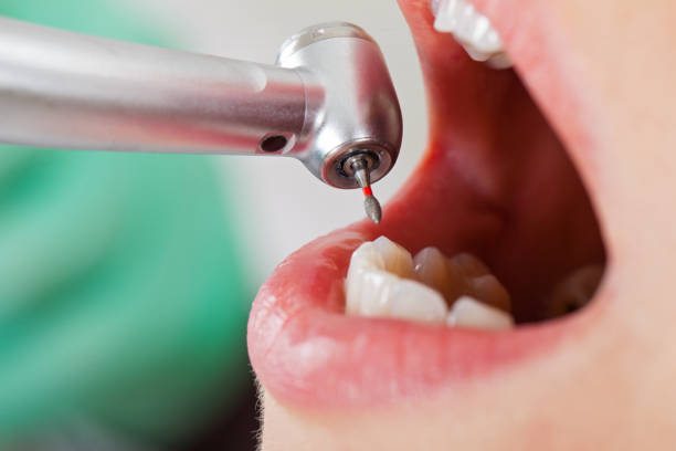 Best Pediatric Emergency Dentist in Upper Ack, NY